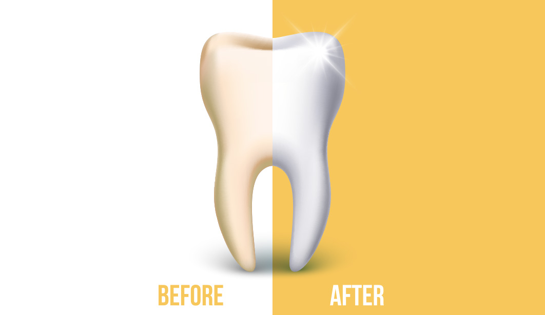 beforeAfter