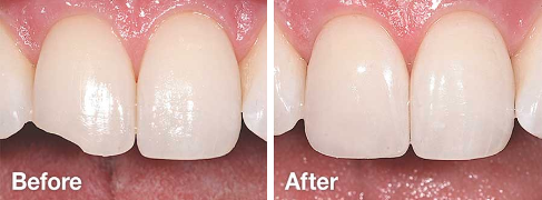 dental_beforeAfter